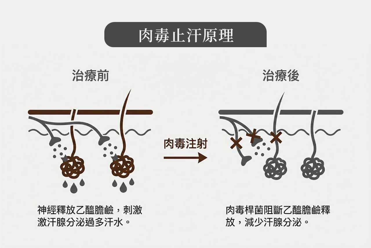 抑制多汗與異味 (止汗) 抑制多汗與異味 (止汗)